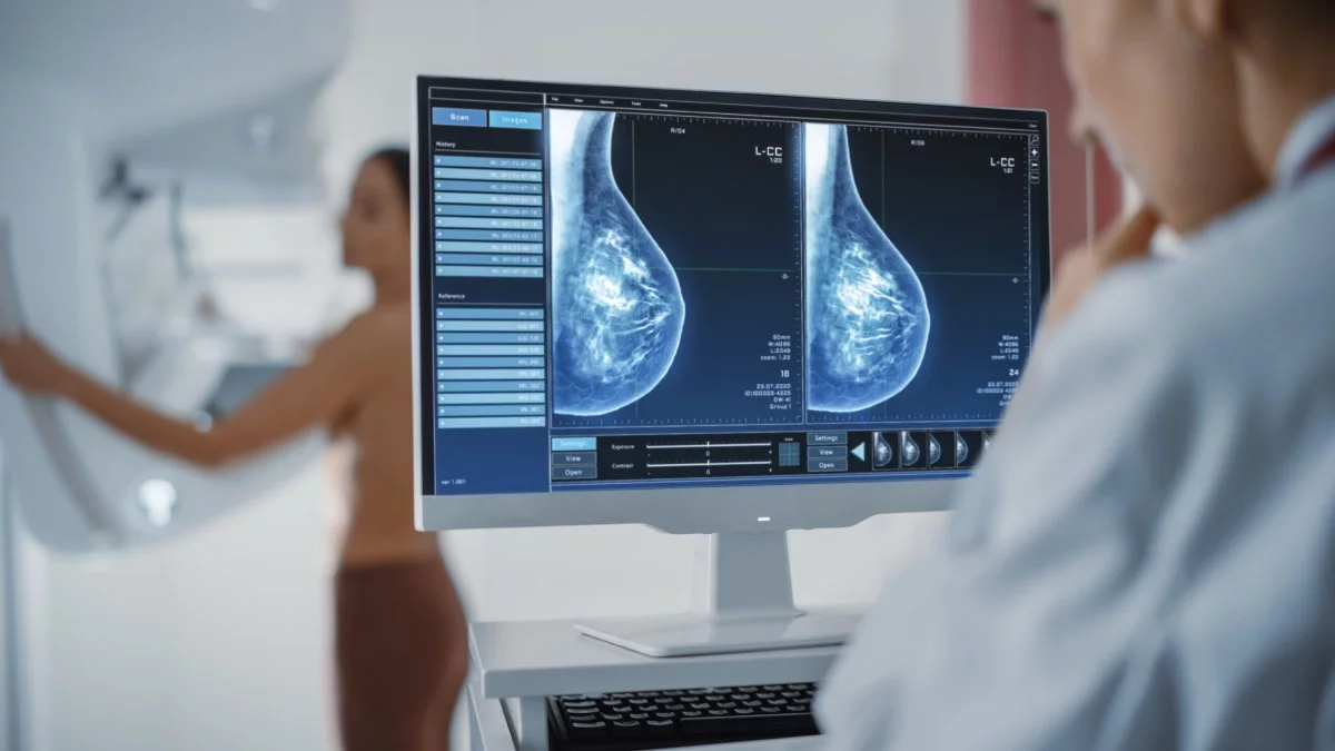Imágenes de una mamografía digital en la pantalla de informes mientras se hace el estudio