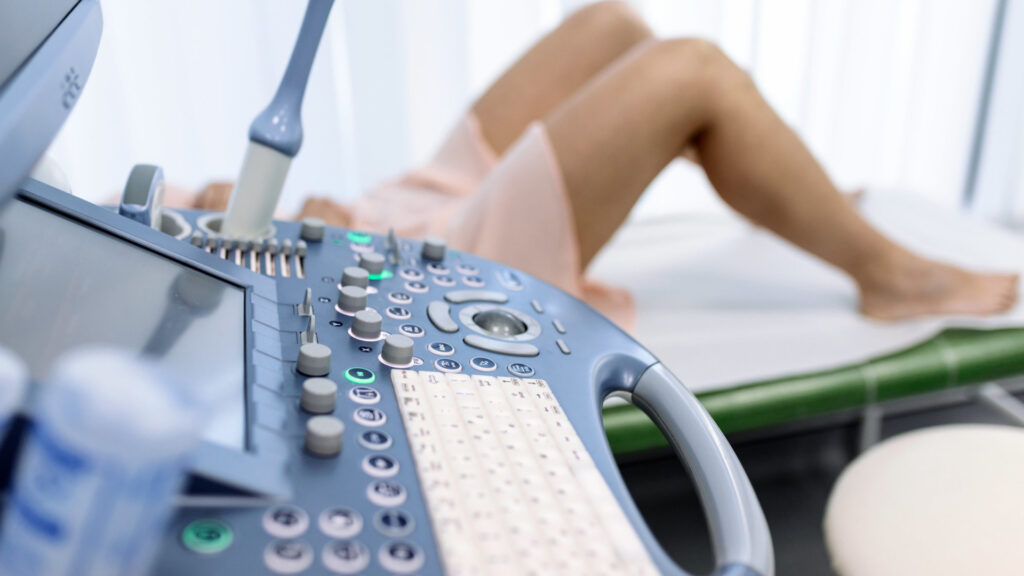 Eco Doppler transvaginal fertilidad reserva ovárica en Medifem-IMAD Bahía Blanca